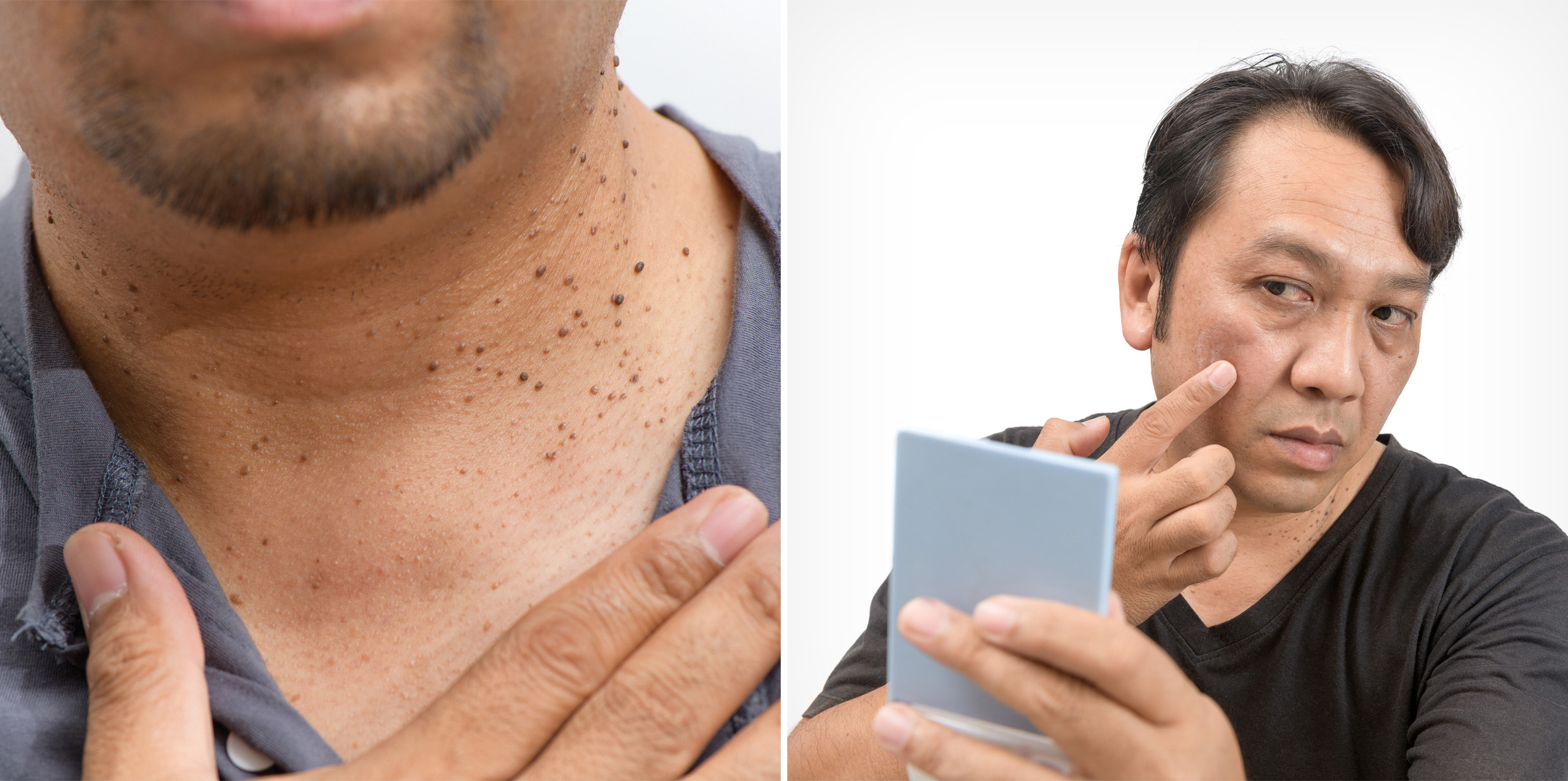 정릉 피부과 05.jpg