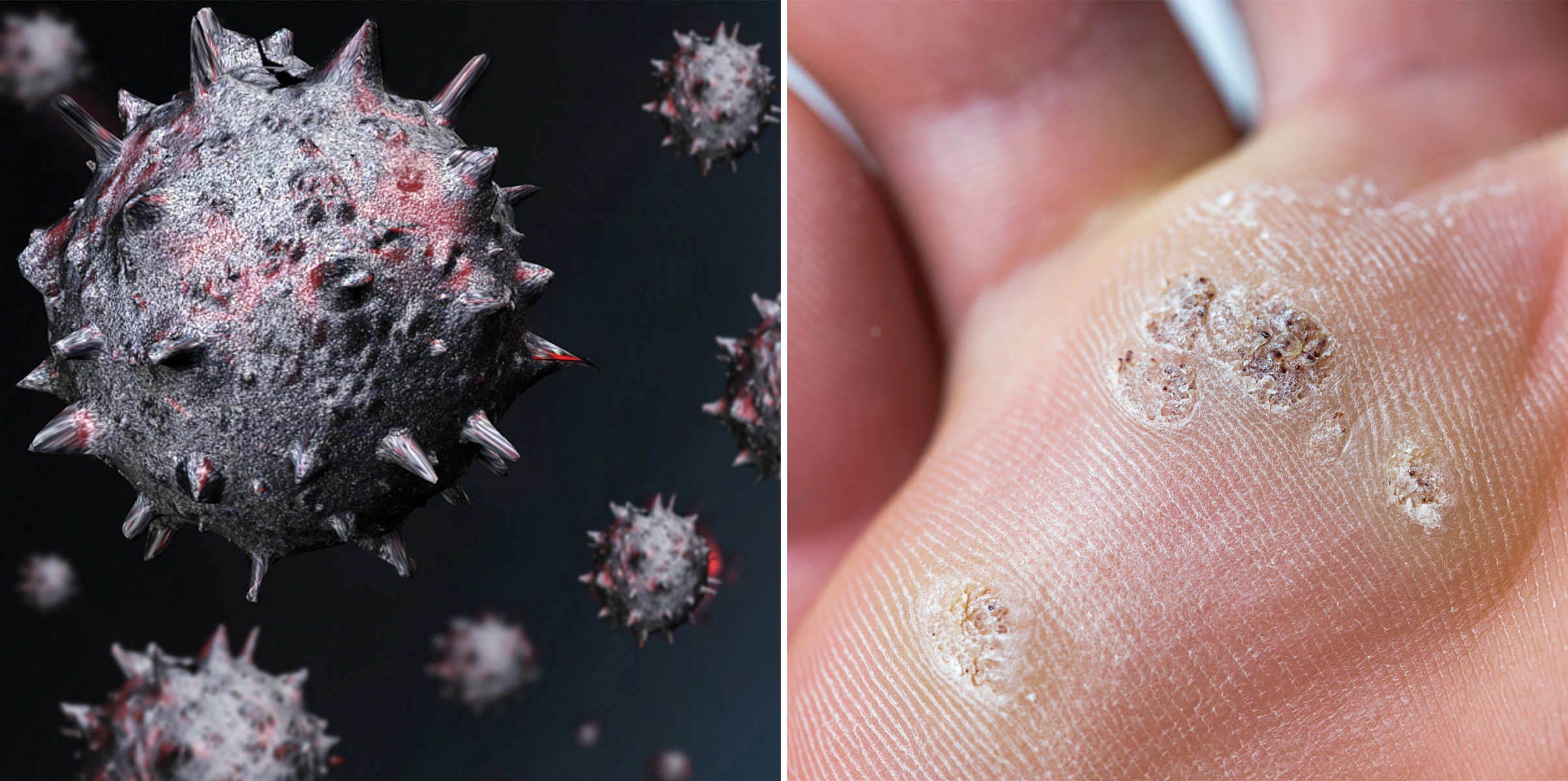 정릉 피부과 01.jpg