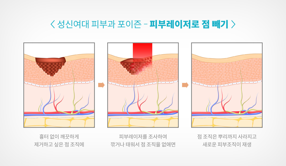 정릉역피부과 06.jpg