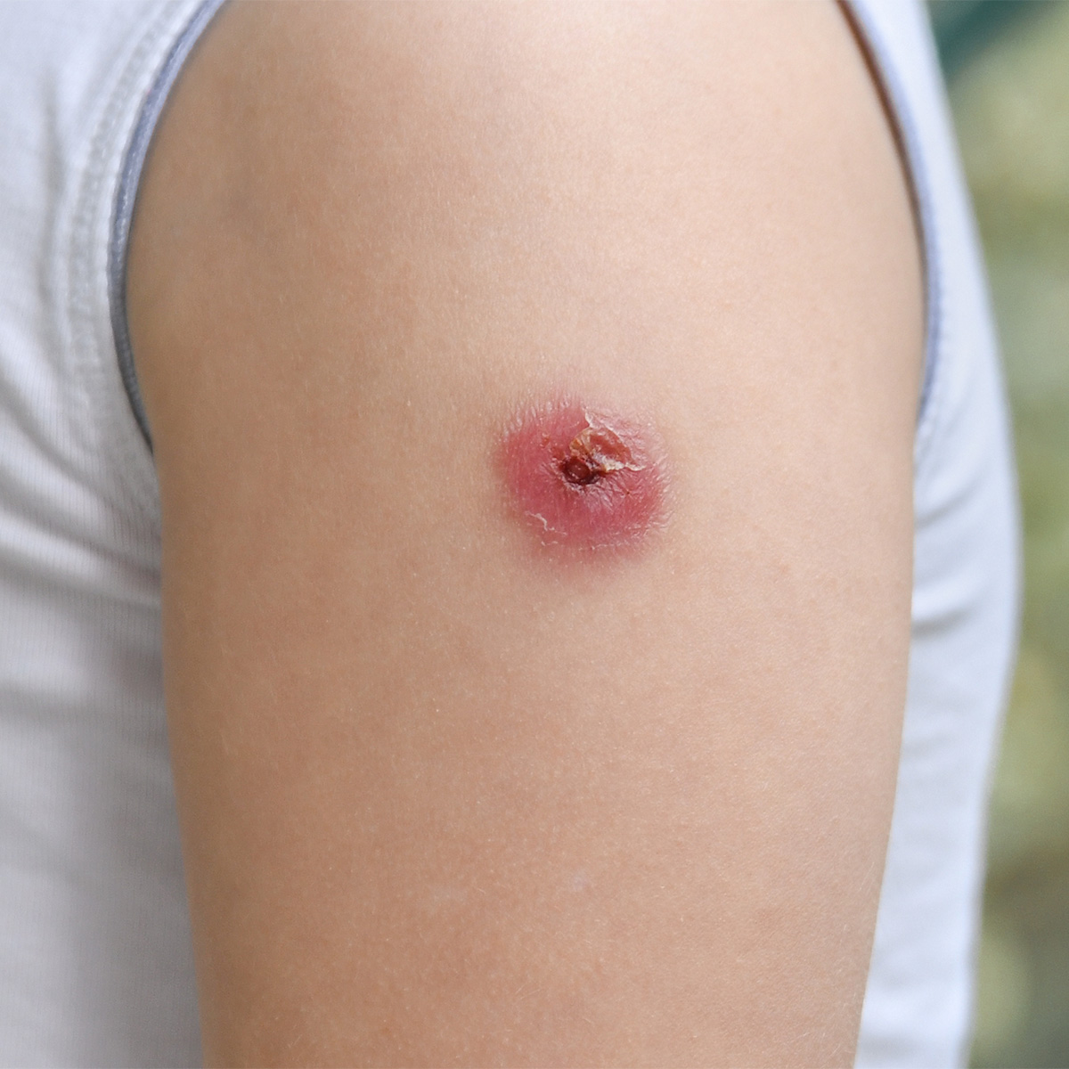 성신여대입구역피부과 11.jpg