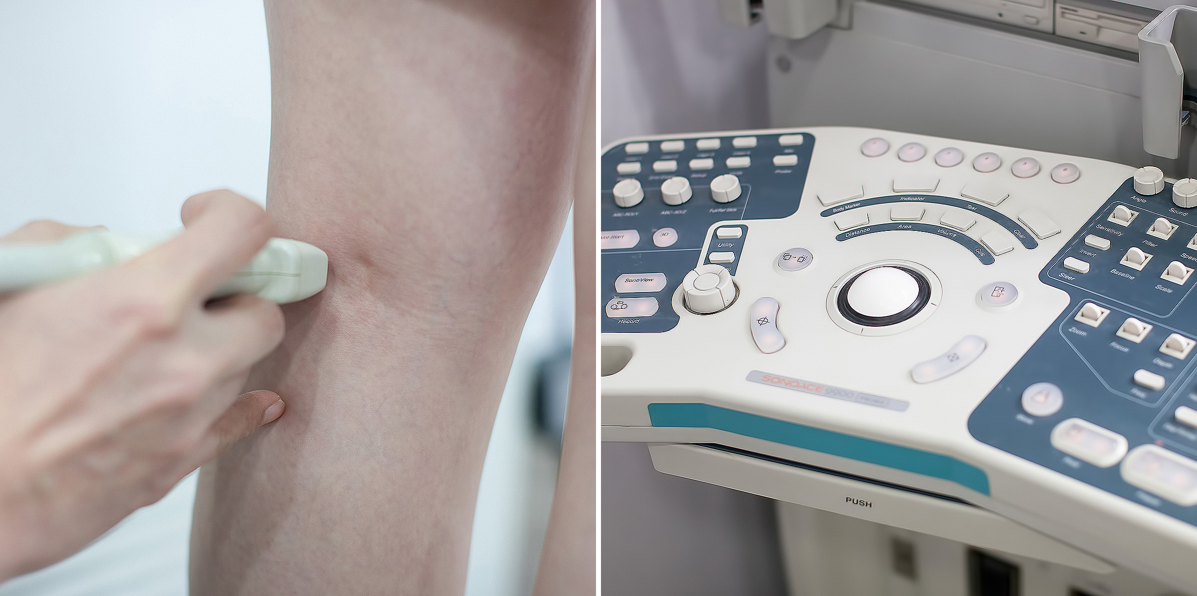 성신여대입구역피부과 07.jpg