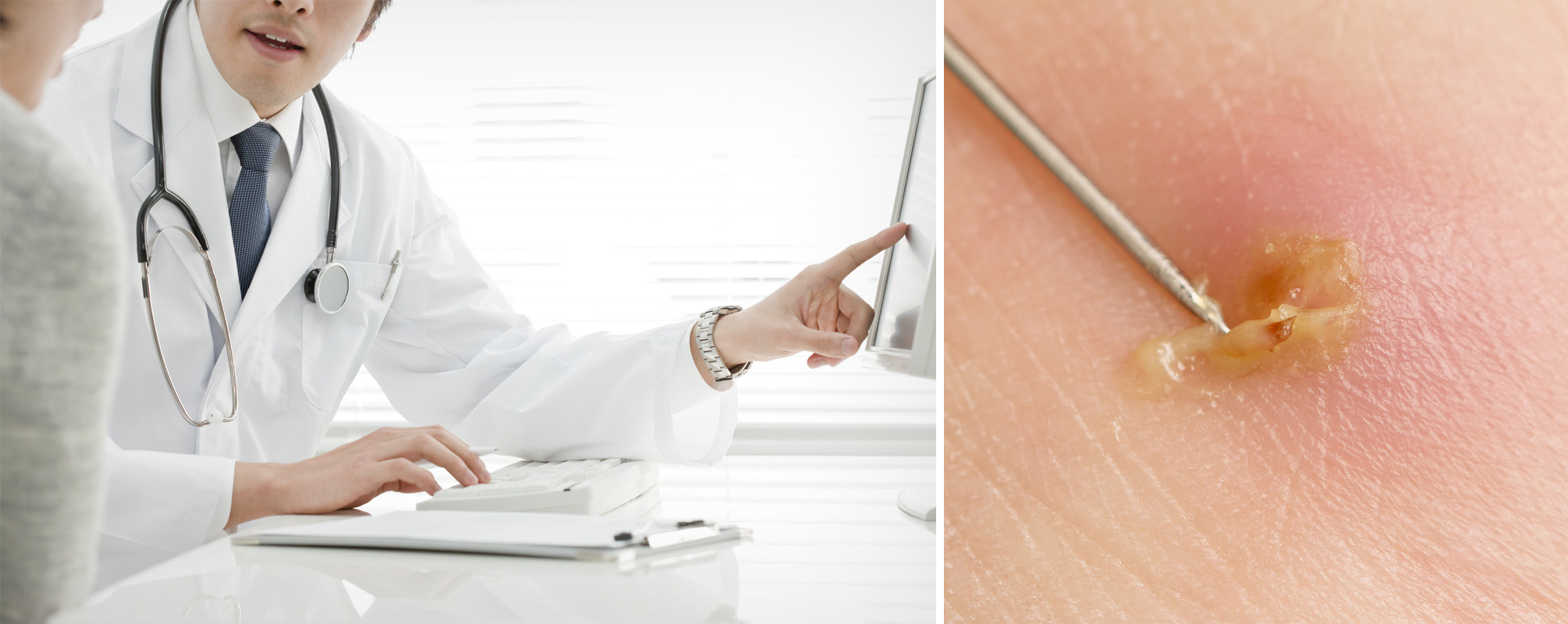 성신여대입구역피부과 03.jpg