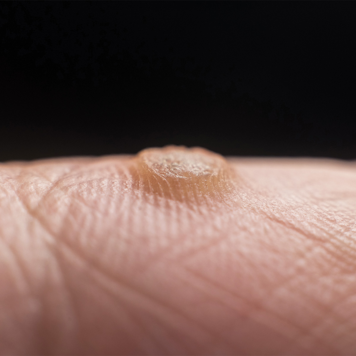 성신여대입구역피부과 09.jpg