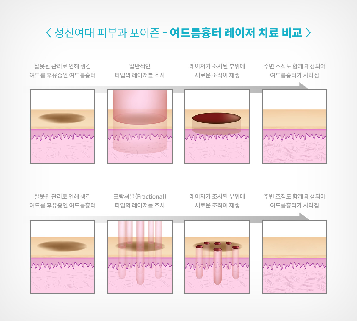 정릉동피부과 07.jpg