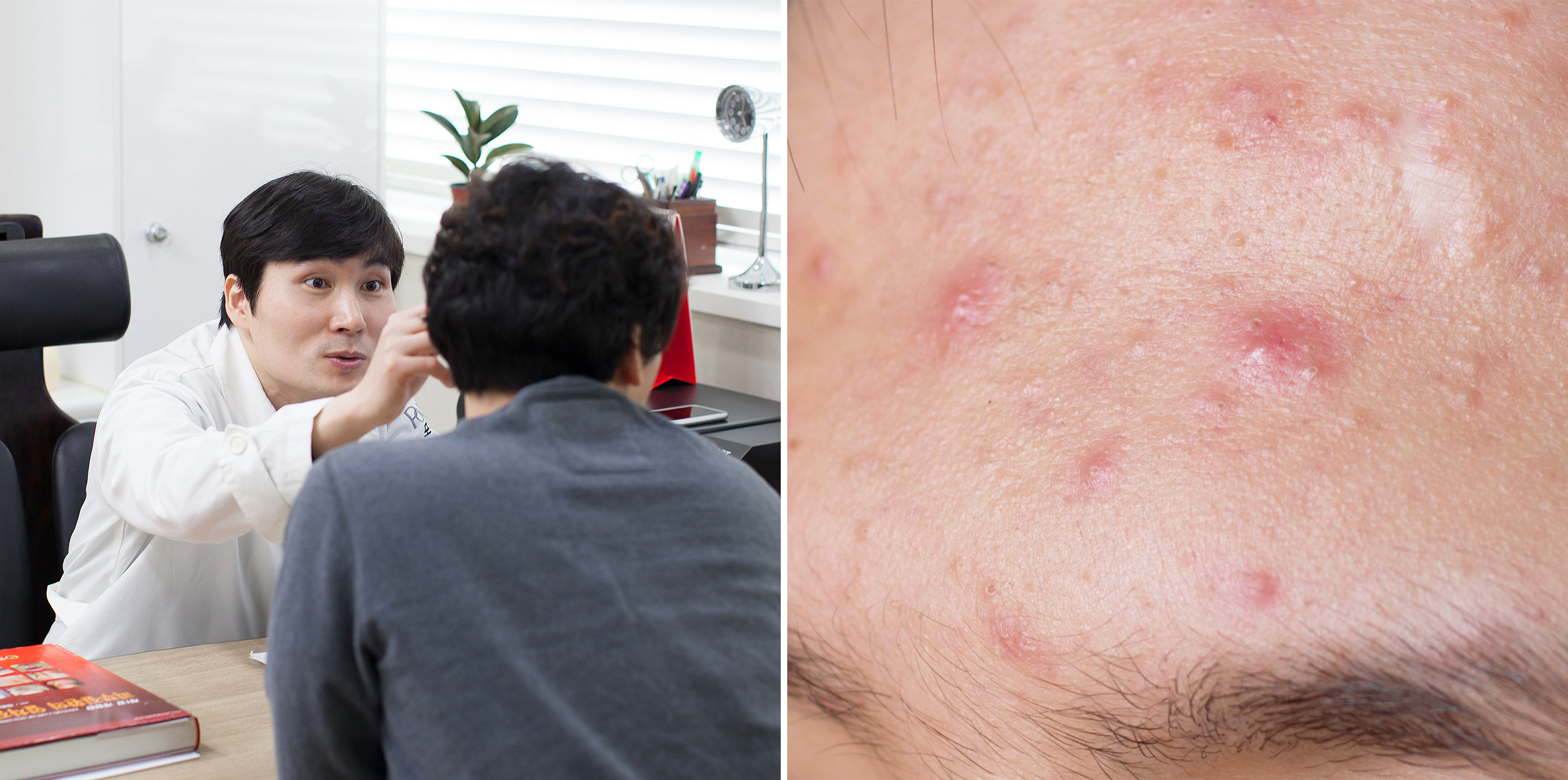 정릉동피부과 02.jpg